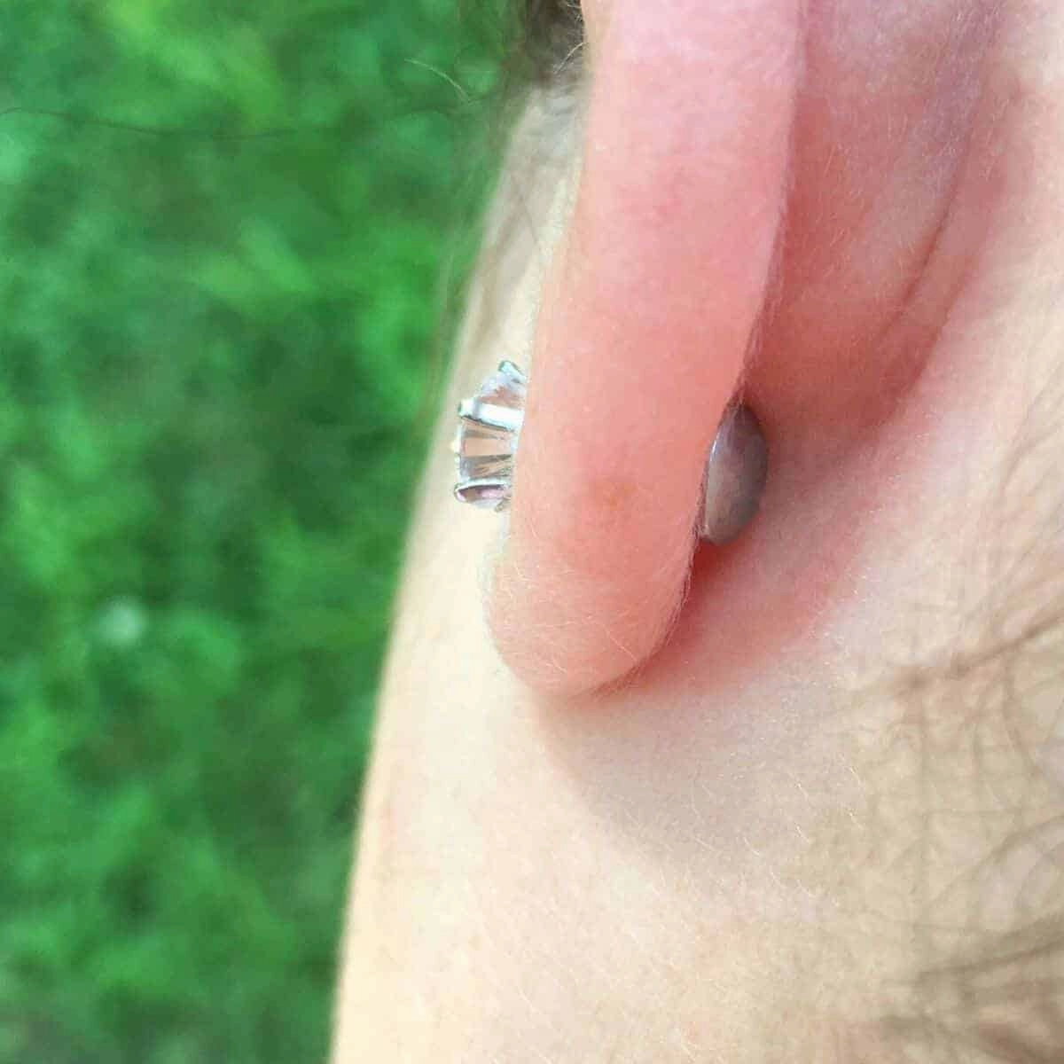 6.0 mm Crystal Prong
