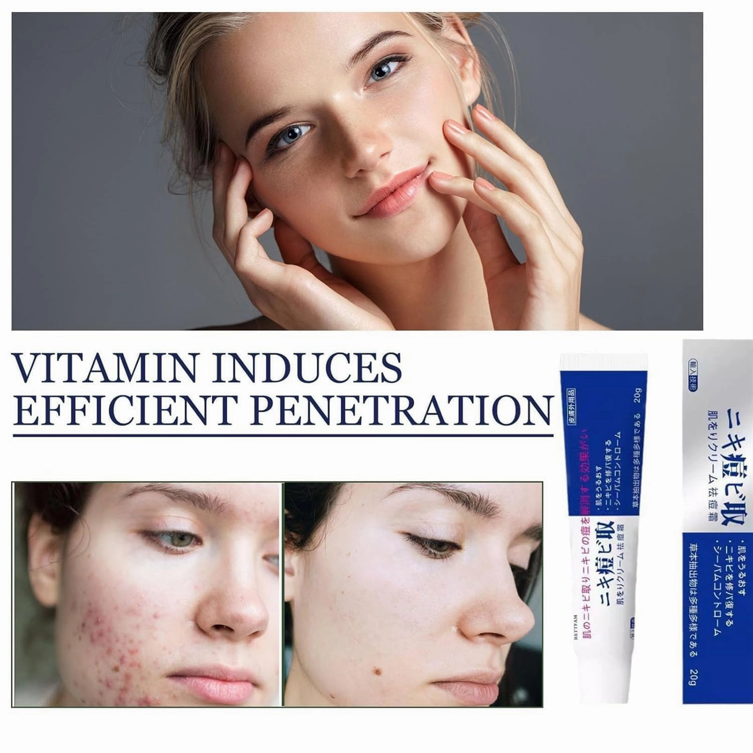 Acne Cream, 20g，Natural Acne Gel for Face，Japanese Moisturizing Treatment for Women & Men (3)