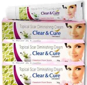 Afflatus Ayurvedic Clear & Cure Anti Acne & Scar Removal Cream || Anti Pigmentation, Anti Blemish || Effective on Burn, Stretch & Post Pregnancy Marks- 30gm (Pack of 3)