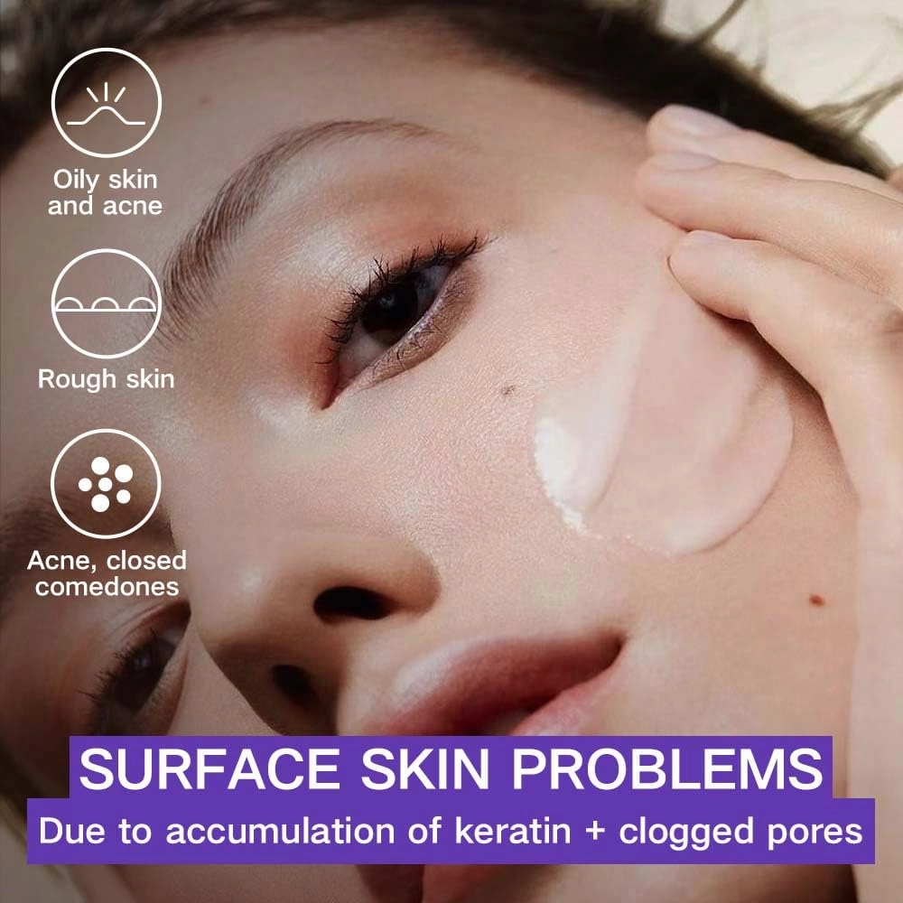 Exfoliator Cream, Facial scrub Exfoliator, Facial scrub, Gentle And Non Irritating, Natural Plant Extracts, Lmprove Skin Texture, For Sensitive & Acne-Prone Skin | 2.82oz (2Pack)