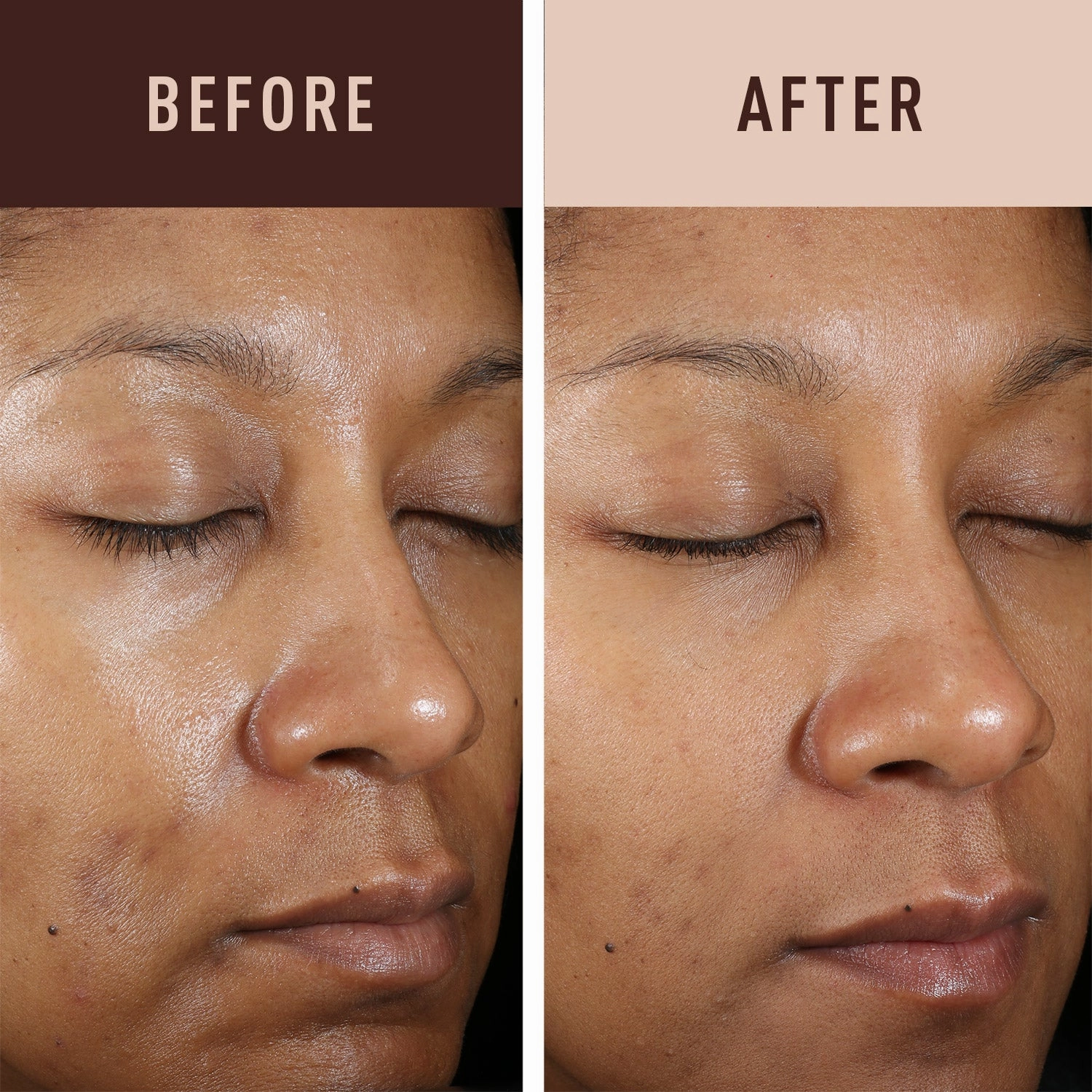 Fade Cream Hydroquinone-Free