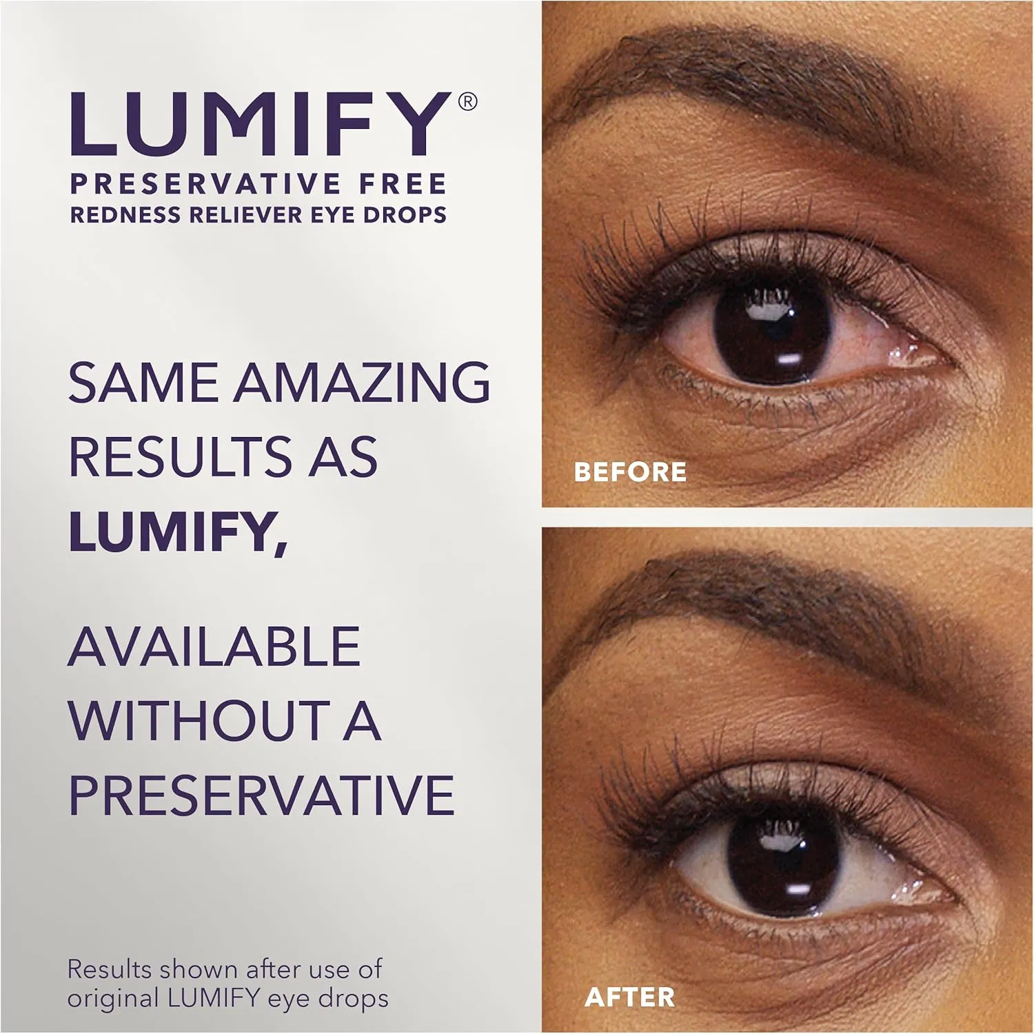 LUMIFY Preservative Free Eye Drops for Red Eyes, Redness Reliever for Sensitive Eyes, Brightens & Whitens, Works in 1 Minute & Lasts Up to 8 Hours, 20 Single-Use Eye Drop Vials