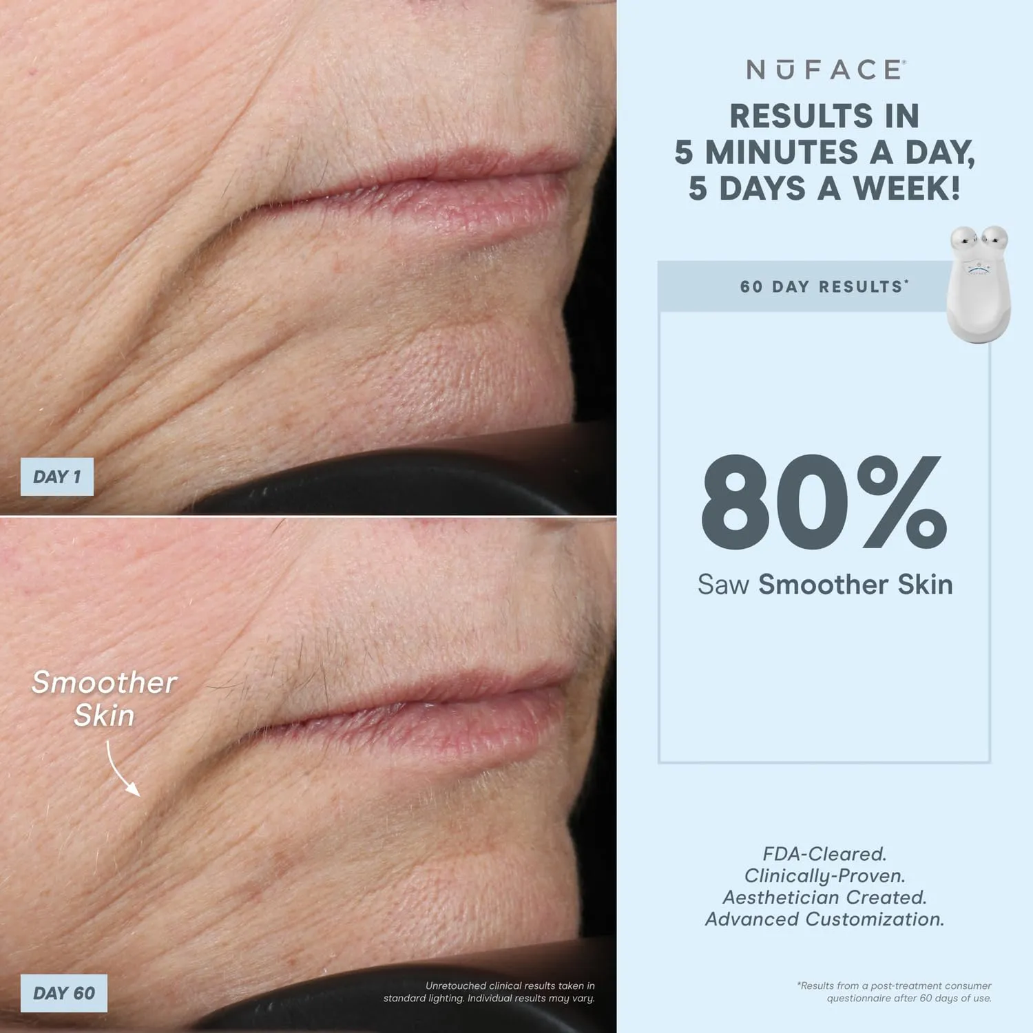 NuFACE FDA Cleared LED Red Light Wrinkle Reducer Attachment for Trinity Microcurrent Facial Device - At Home 3-Minute Fine Lines and Wrinkles Treatment for Smile Lines, Under Eyes & Forehead