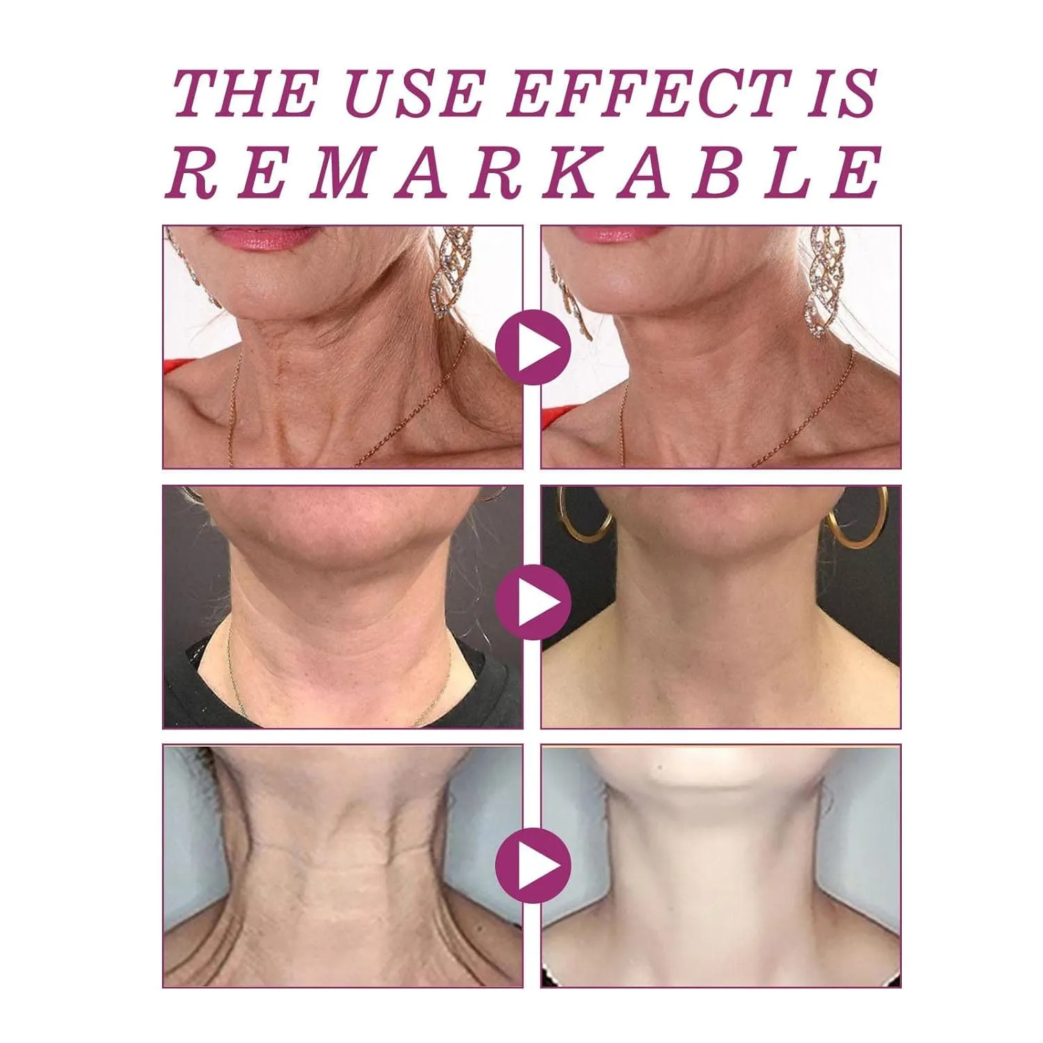 Spain NECKPON Hydrolized Collagen Neck Cream, Neck Firming Cream Tightening Sagging Skin Anti Aging Collagen Firming Cream for Neck (3pcs)
