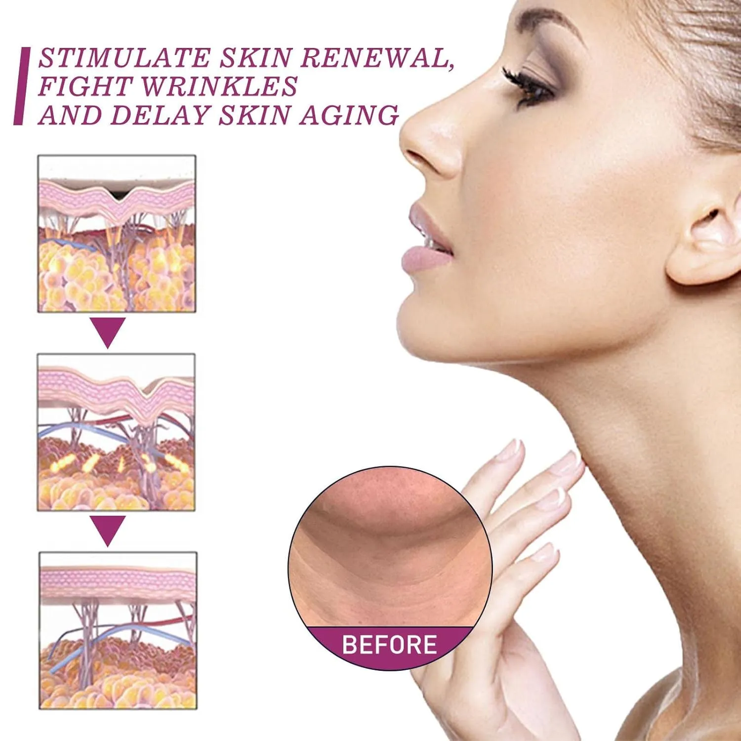 Spain NECKPON Hydrolized Collagen Neck Cream, Neck Firming Cream Tightening Sagging Skin Anti Aging Collagen Firming Cream for Neck (3pcs)